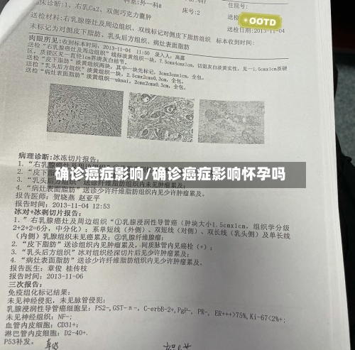 确诊癌症影响/确诊癌症影响怀孕吗-第2张图片