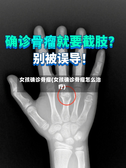 女孩确诊骨瘤(女孩确诊骨瘤怎么治疗)