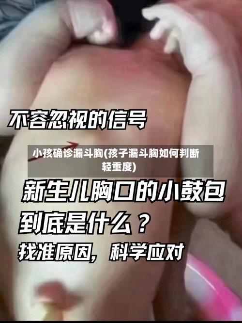 小孩确诊漏斗胸(孩子漏斗胸如何判断轻重度)