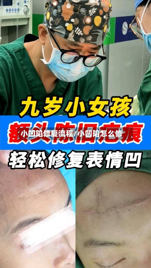 小凹陷修复流程/小凹陷怎么修-第3张图片