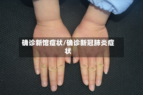 确诊新馆症状/确诊新冠肺炎症状-第2张图片